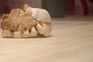 Najstariji u svetu plombirani zub