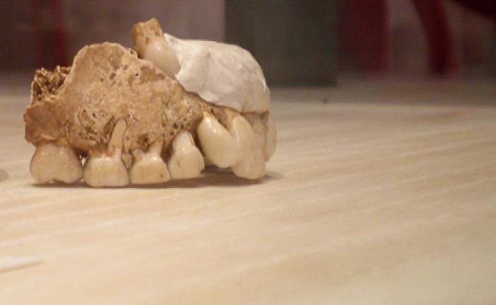 Najstariji u svetu plombirani zub