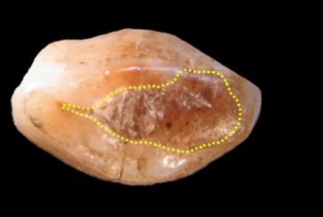 Arheolozi pronašli zubno punjenje staro 6.500 godina