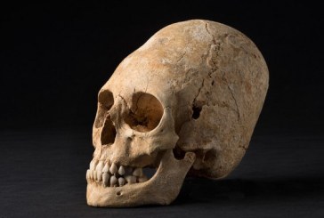 NEOBIČAN OBLIK GLAVE: Iskopana lobanja bogatašice iz ‘mračnog doba’