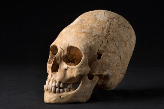 NEOBIČAN OBLIK GLAVE: Iskopana lobanja bogatašice iz ‘mračnog doba’